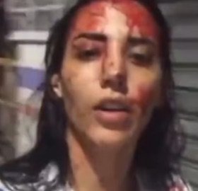 MULHER É DETIDA POR ESFAQUEAR NAMORADO E ALEGA QUE SOFRIA VIOLÊNCIA DOMÉSTICA