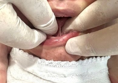 Após pedido de Eduarda Sampaio, Centro de Especialidades Odontológicas de Salgueiro fará ‘teste da linguinha’ em recém-nascidos