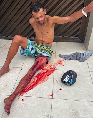 DOIS HOMENS FORAM VÍTIMAS DE TENTATIVA DE ASSASSINATO NO BAIRRO CENTENÁRIO EM CARUARU